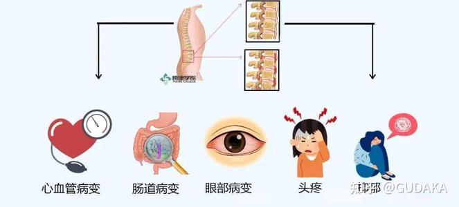 强直性脊柱炎会导致频繁中耳炎吗
