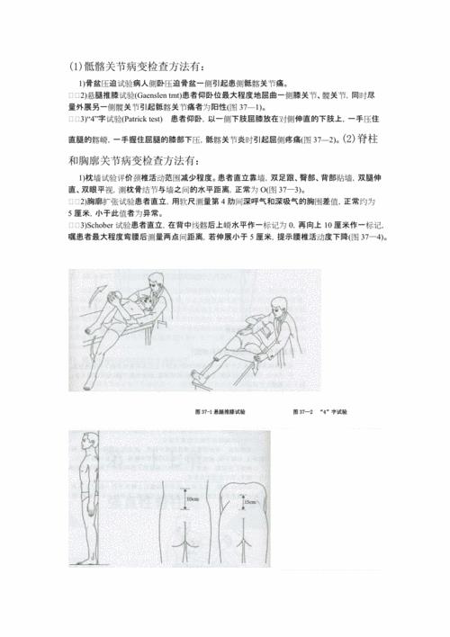 强直性脊柱炎哪些指标确定