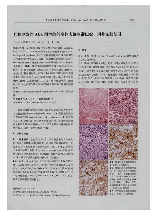 间变性大细胞淋巴瘤