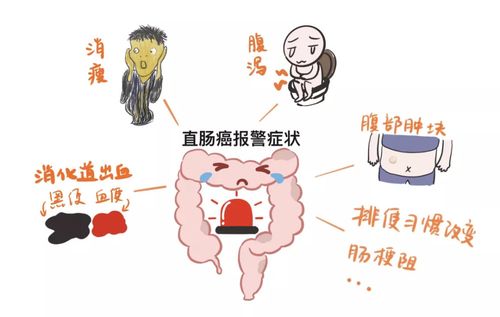 得溃疡性结肠炎但体重不减轻