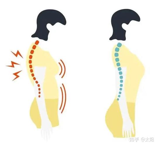 强直性脊柱炎目前有治愈的可能吗