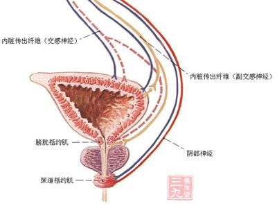 膀胱过度活动症