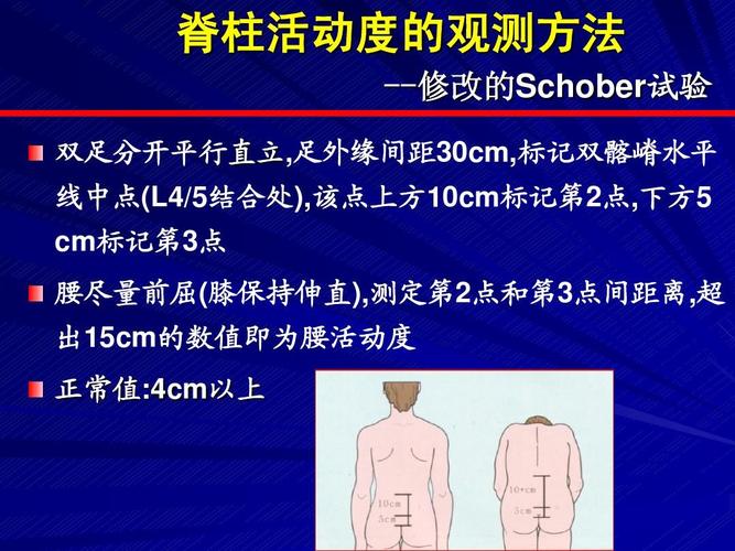 强直性脊柱炎的诊断和治疗