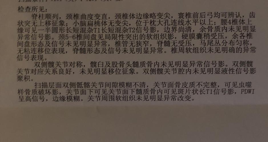 强直性脊柱炎阴性