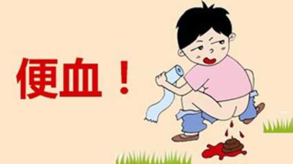 溃疡性结肠炎痔疮