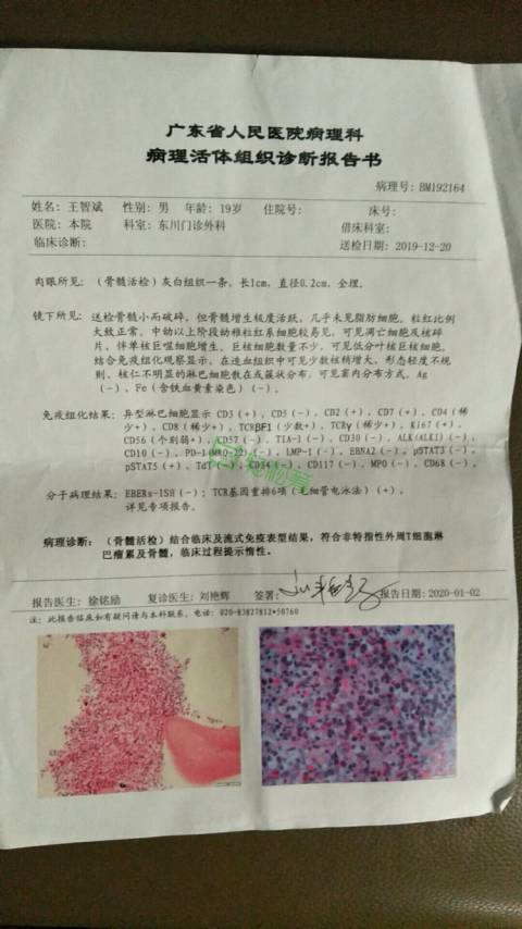 T细胞淋巴瘤