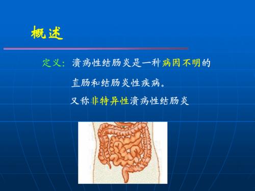 保济丸溃疡性结肠炎