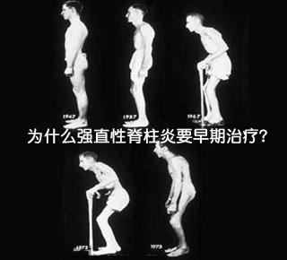 强直性脊柱炎从颈椎发作吗