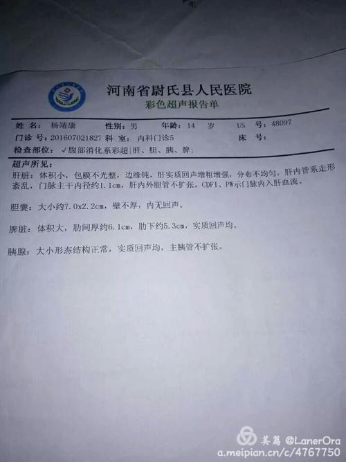 肝豆状核变性