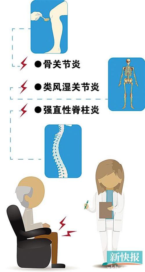 骨性关节炎与强直性脊柱炎区别