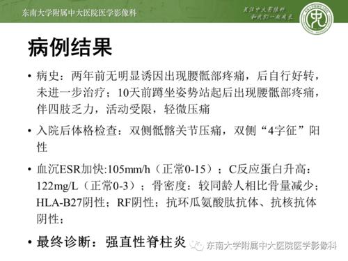 强直性脊柱炎可以考教师编制吗