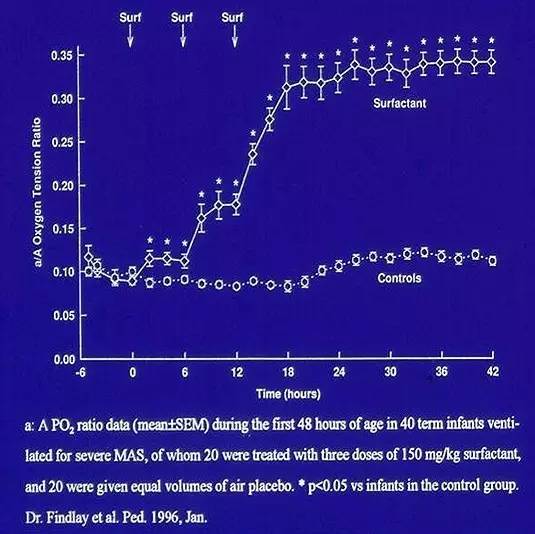何少茹:胎粪吸入综合征发病机制和治疗现状