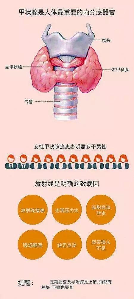 甲状腺癌