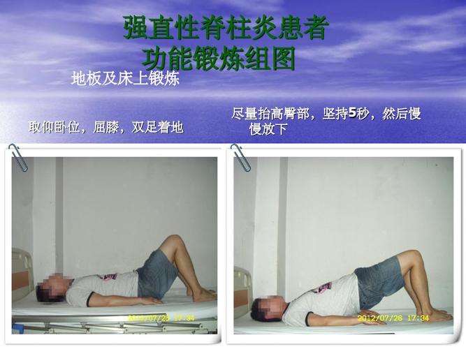 强直性脊柱炎练太极拳好吗