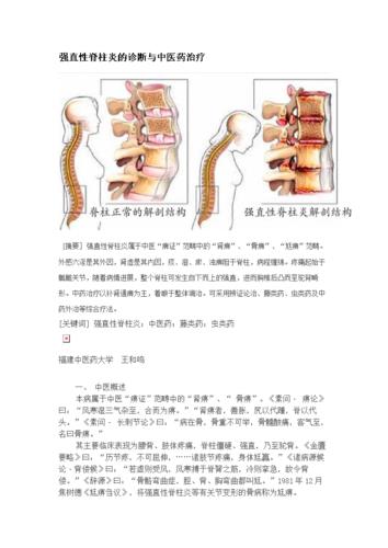 阴虚型强直性脊柱炎焦树德