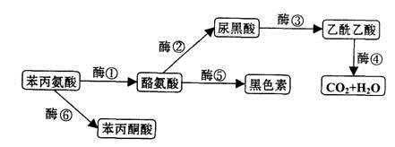 苯丙酮尿症