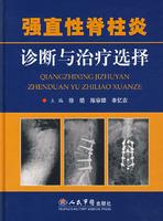 香蕉抗肿瘤因子治疗强直性脊柱炎