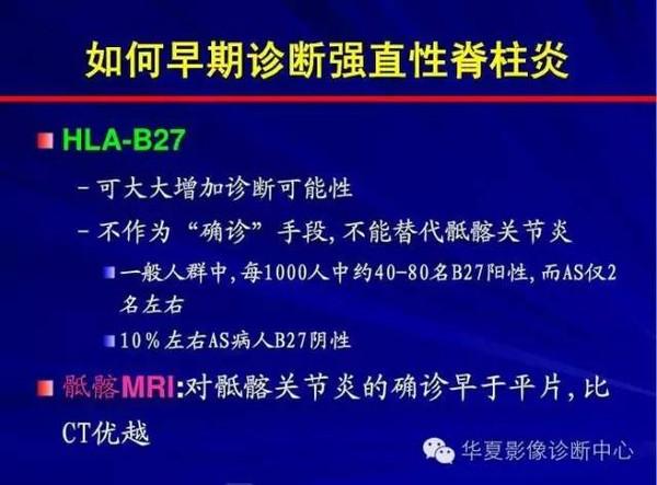 强直性脊柱炎可以办理门诊报销吗