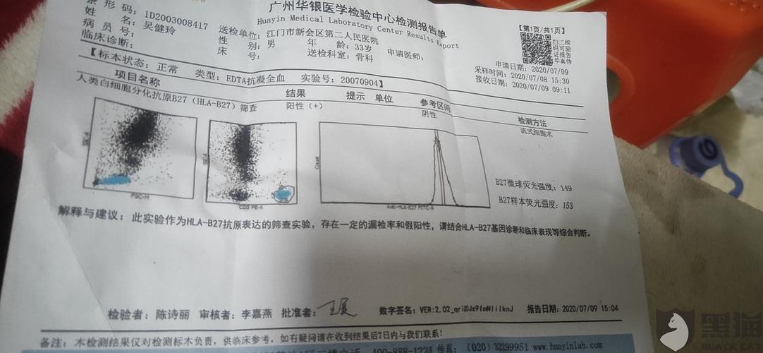 强直性脊柱炎排除检查