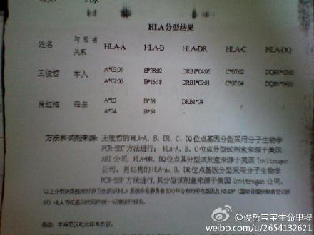 强直性脊柱炎b27是显性基因吗