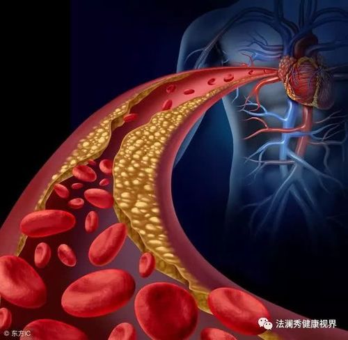 同型半胱氨酸血症