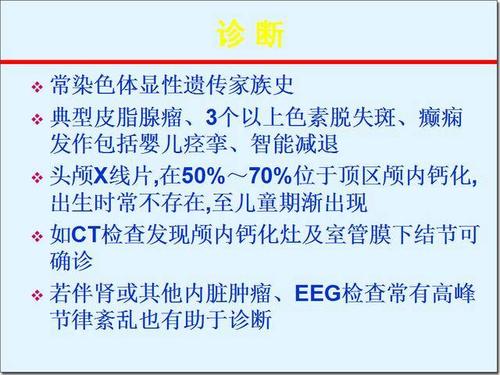 结节性硬化症