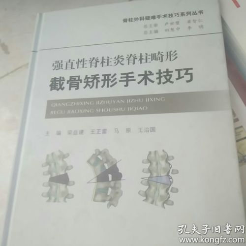 强直性脊柱炎中医病名
