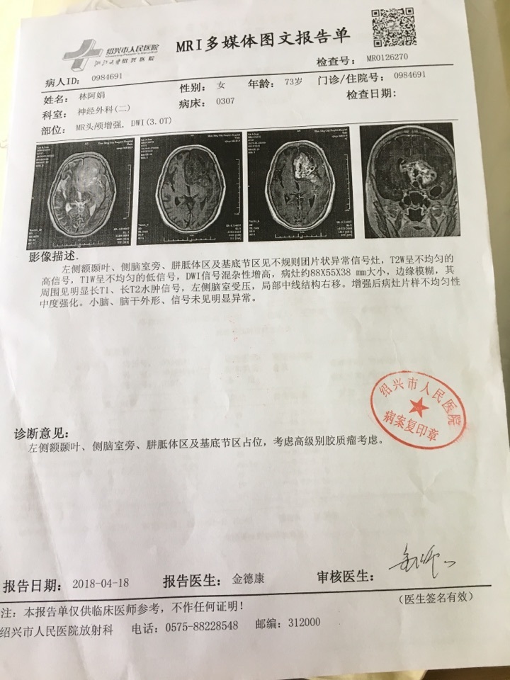 贝伐珠单抗靶向是啥_胶质母细胞瘤脑水肿打贝伐单抗_贝伐单抗和贝伐珠单抗