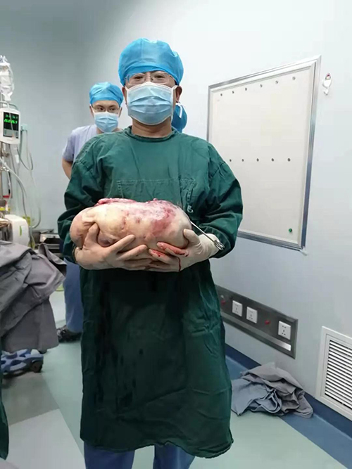 贝伐珠单抗是化疗药吗_胶质母细胞瘤脑水肿打贝伐单抗_打贝伐珠单抗能不能停药