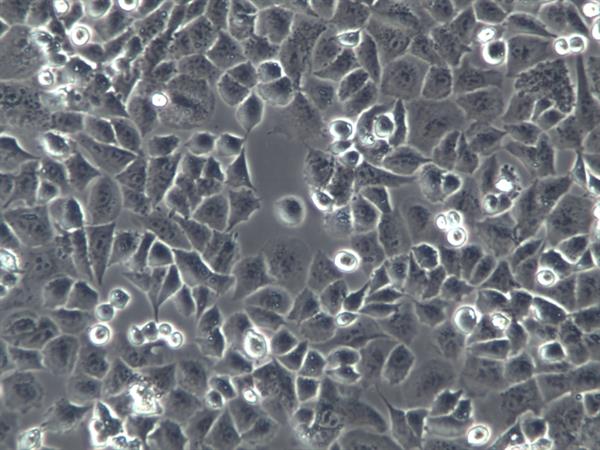 胶质母细胞瘤病人的药理机制——2.贝伐单抗联合治疗方案