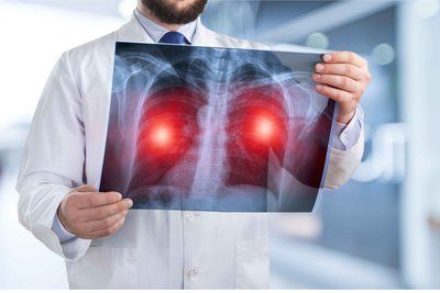 是否意味着肺癌进入到了晚期转移就不可治疗了呢？