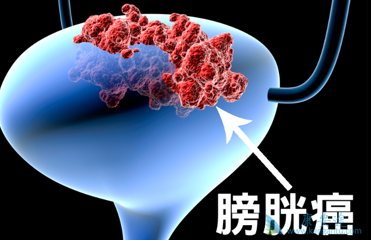 华夏肿瘤康复网为患者降低高额的医疗费用是什么？