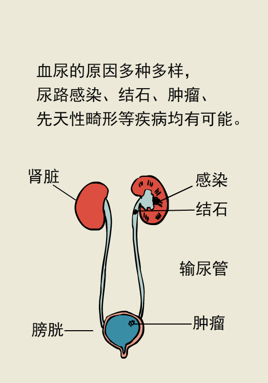 贝伐单抗耐药性_贝伐珠单抗可以报销吗_贝伐单抗肠癌适应症