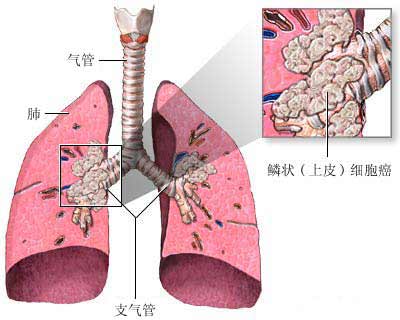 黑盒奥希替尼与原版效果比较_奥希替尼多少钱一盒_9291奥希替尼价格