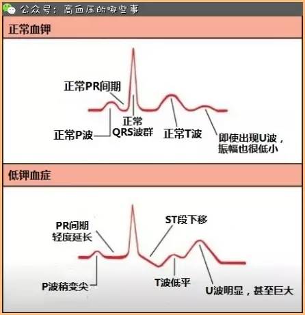 贝伐珠单抗不良反应_贝伐单抗对右半结肠癌效果_西妥昔单抗贝伐单抗