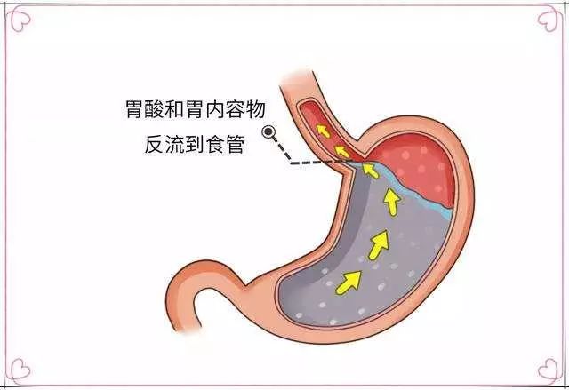 服用吉非替尼后大便时小肚子疼_小肚子不舒服总想大便_新生儿服用茵栀黄后大便颜色