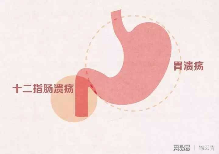 新生儿服用茵栀黄后大便颜色_小肚子不舒服总想大便_服用吉非替尼后大便时小肚子疼