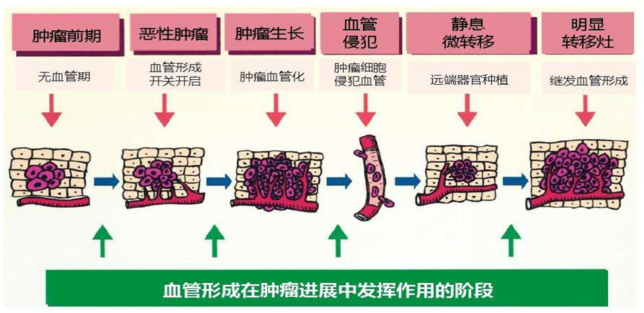 贝伐单抗用多久耐药_贝伐珠单抗耐药周期_贝伐珠单抗是化疗吗