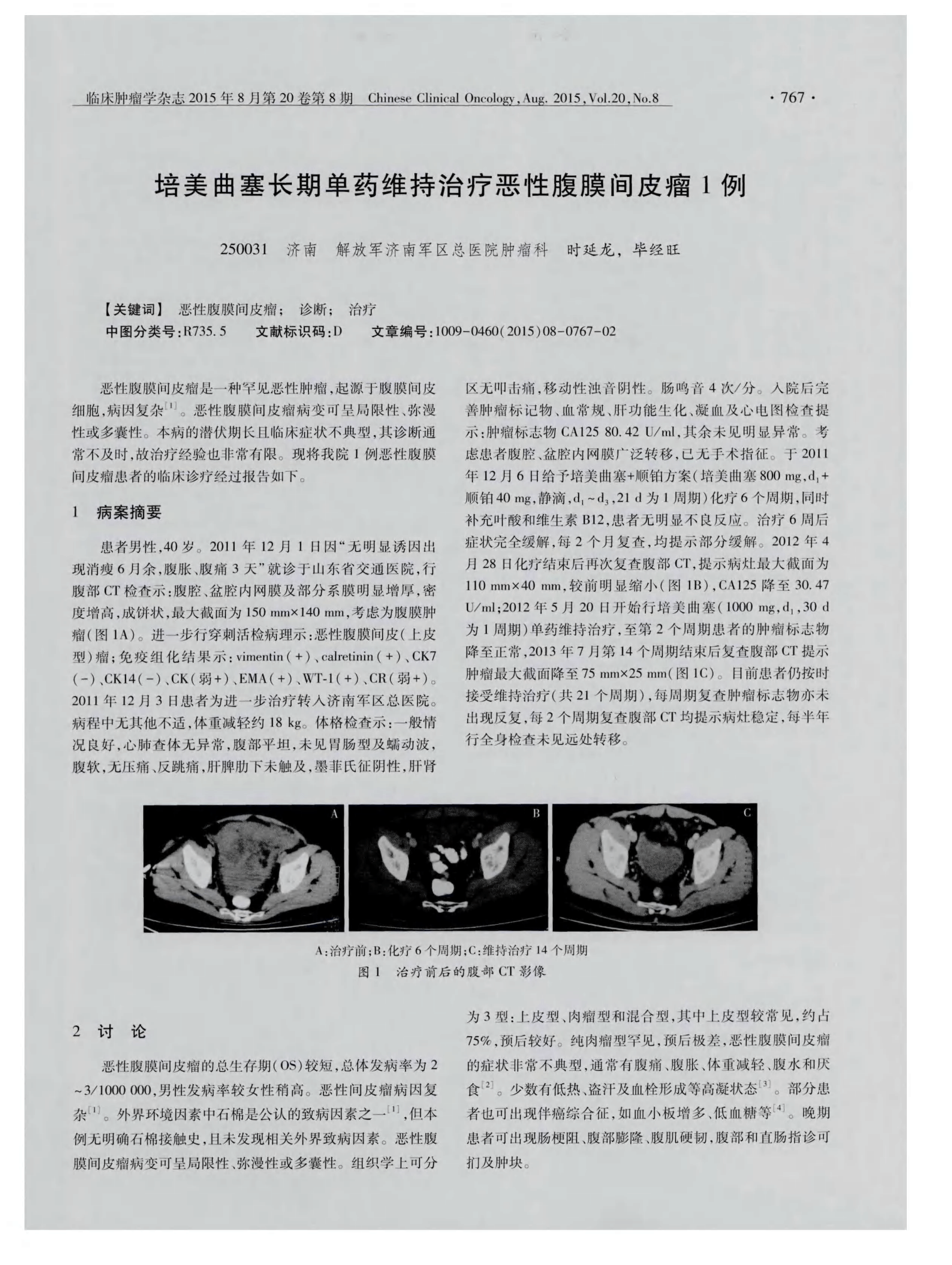培美曲塞二钠临床实践指南（中国版）——培美曲塞的作用机制
