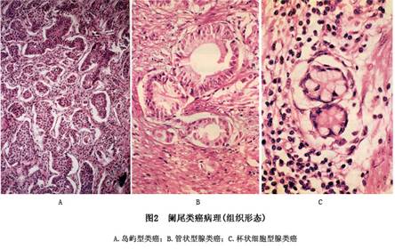 贝伐珠单抗用多久后可以手术_贝伐珠单抗注射液_贝伐珠单抗报销后价格