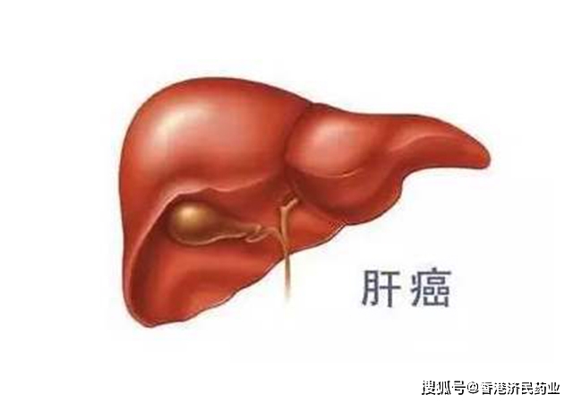 甲苯磺酸索拉非尼片_索拉非尼_索拉非尼的治疗