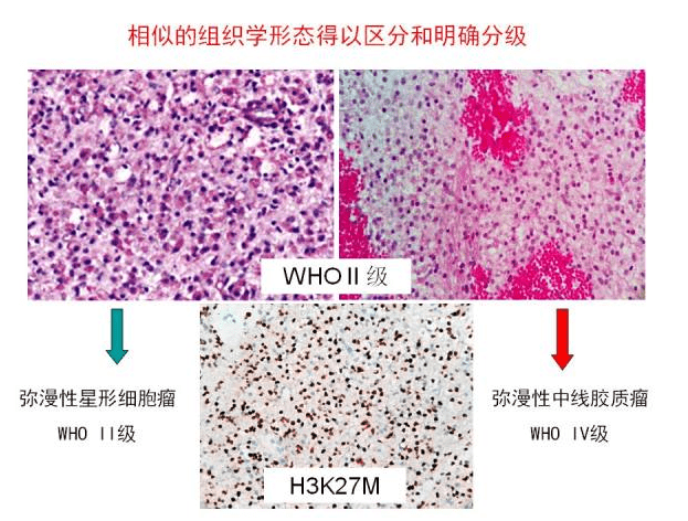 贝伐珠单抗多少钱一支_贝伐珠单抗 耐药性_贝伐珠单抗stk11