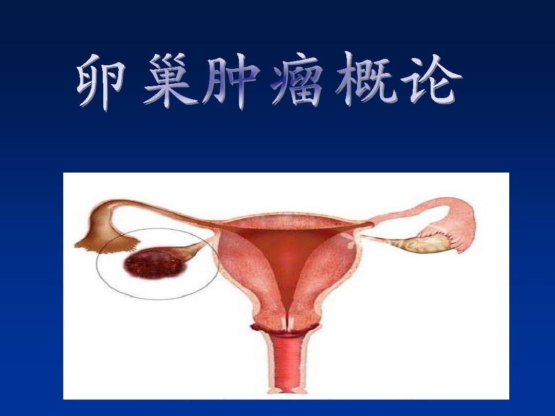 贝伐单抗对什么癌好_奥拉帕尼十贝伐单抗治疗卵巢癌_贝伐珠单抗可以报销吗