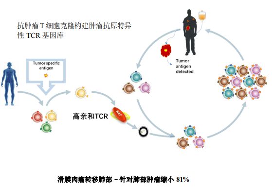肺癌脑转移吃克唑替尼_阿帕替尼对肺癌有效吗_肺癌吃吉非替尼有什么反应