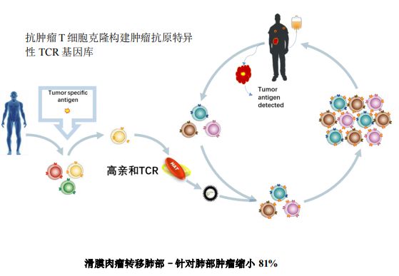 EGFR基因突变仍可以口服吉非替尼靶向治疗，印度易瑞沙替尼