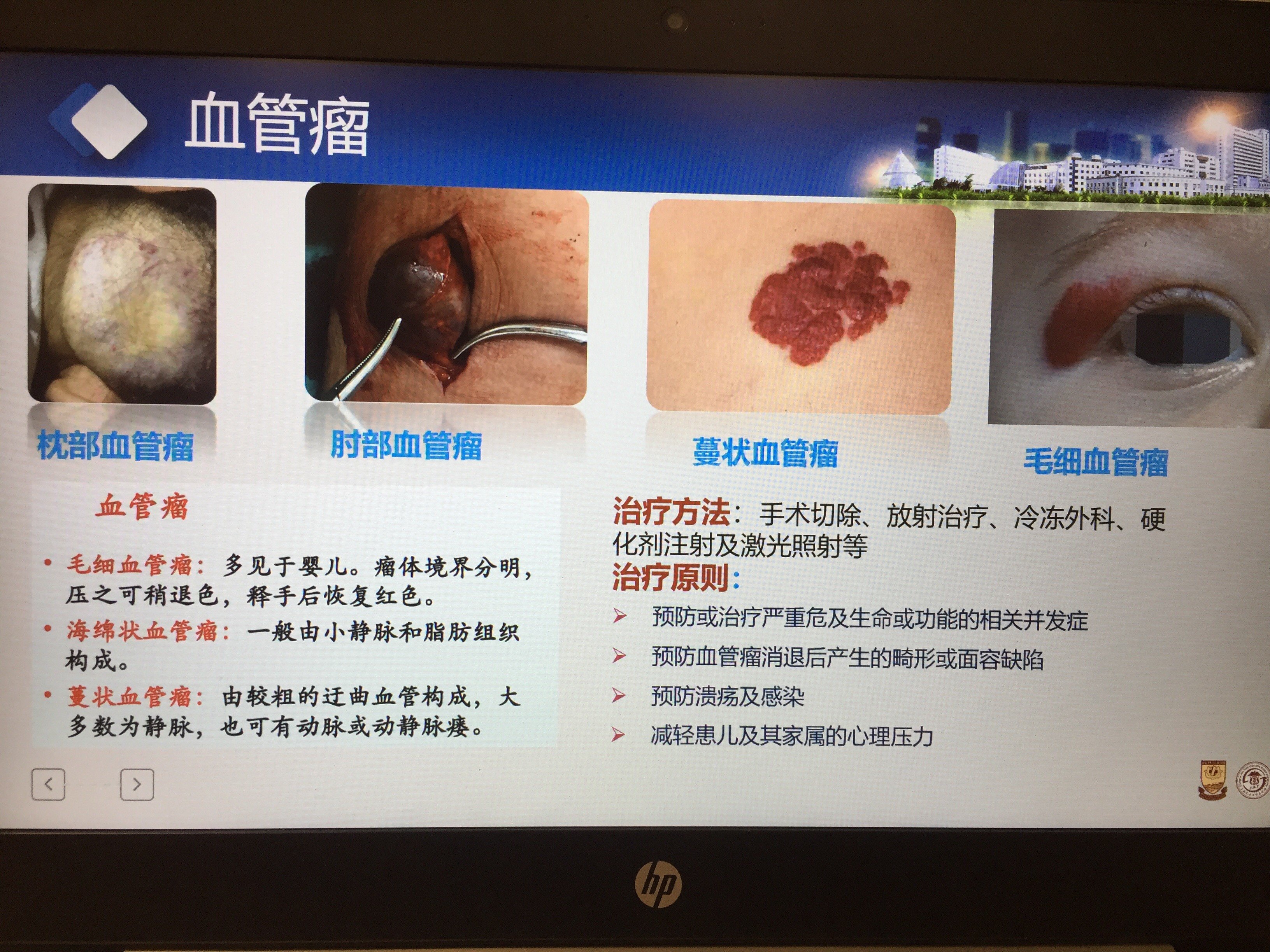贝伐珠单抗4个月后赠药_贝伐单抗多少钱拿赠药_贝伐单抗有赠药吗