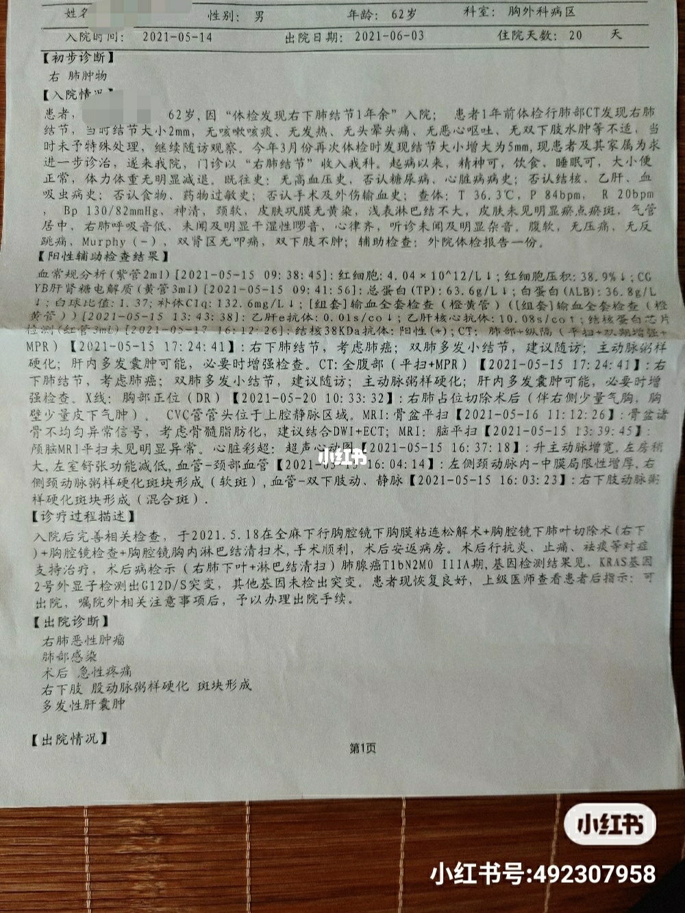 肛门腺癌好治吗是怎么引起的_吉非替尼能治好晚期肺腺癌吗_贲门腺癌好治吗