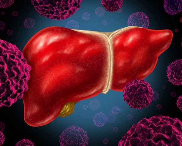 
肝癌治疗迎来一个新突破，肝癌靶向药进入靶向治疗时代