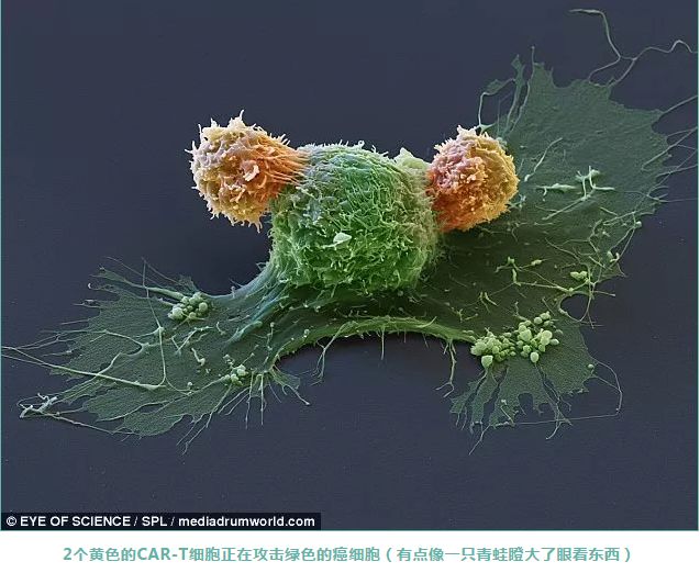 索拉非尼价格_索拉非尼要做基因检测么_索拉非尼副作用比伦伐替尼大吗