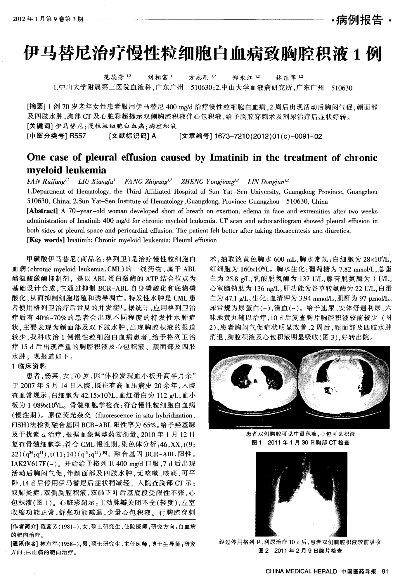 索拉非尼耐药后换索坦_奥希替尼9291药品_奥希替尼耐药后的突变
